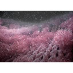 Microplastic Filter